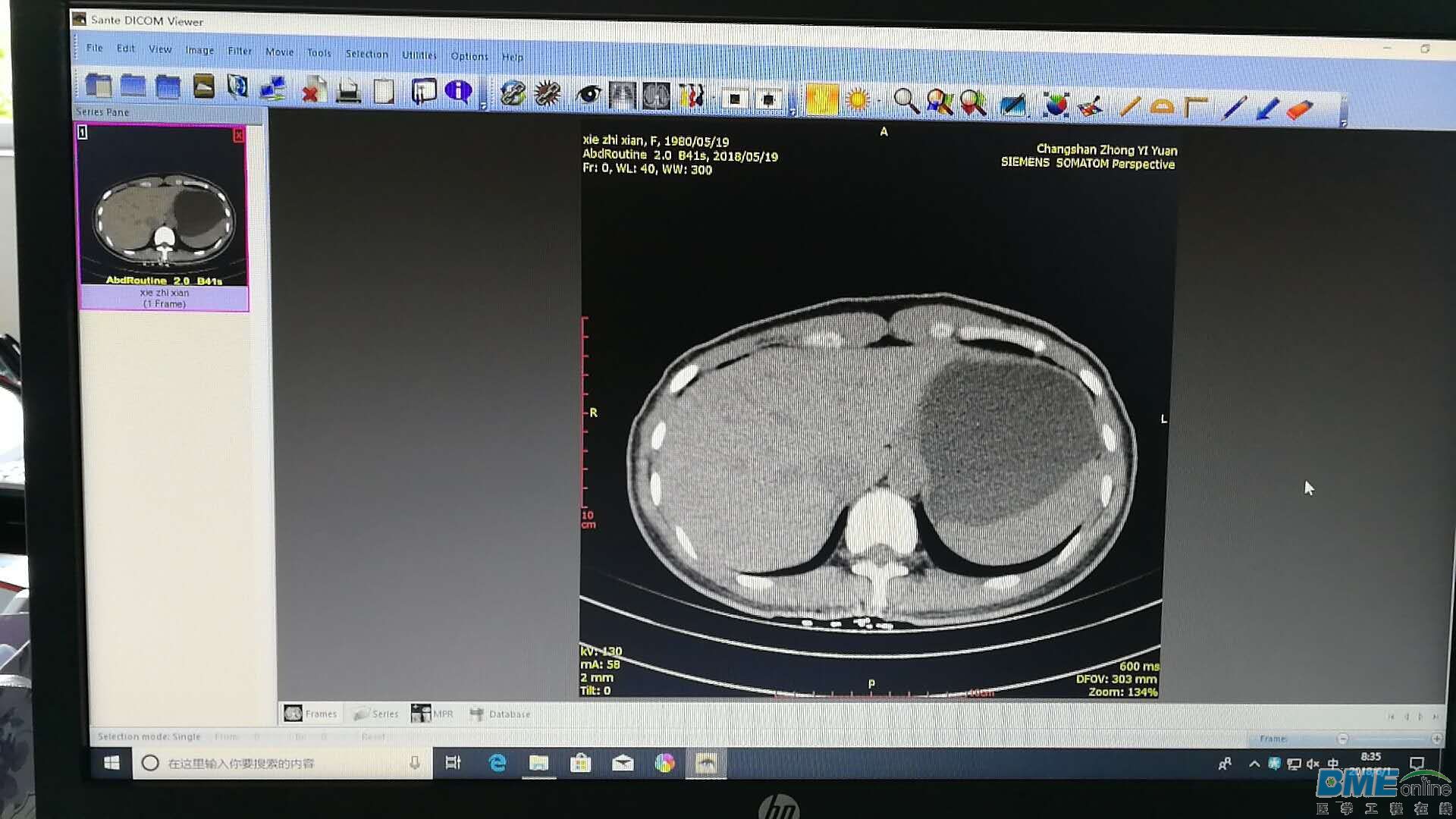 其他软件可以读图