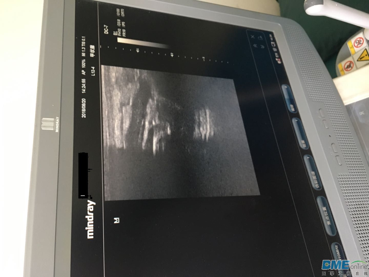 迈瑞DC-7彩超L12-4探头故障图片.jpg
