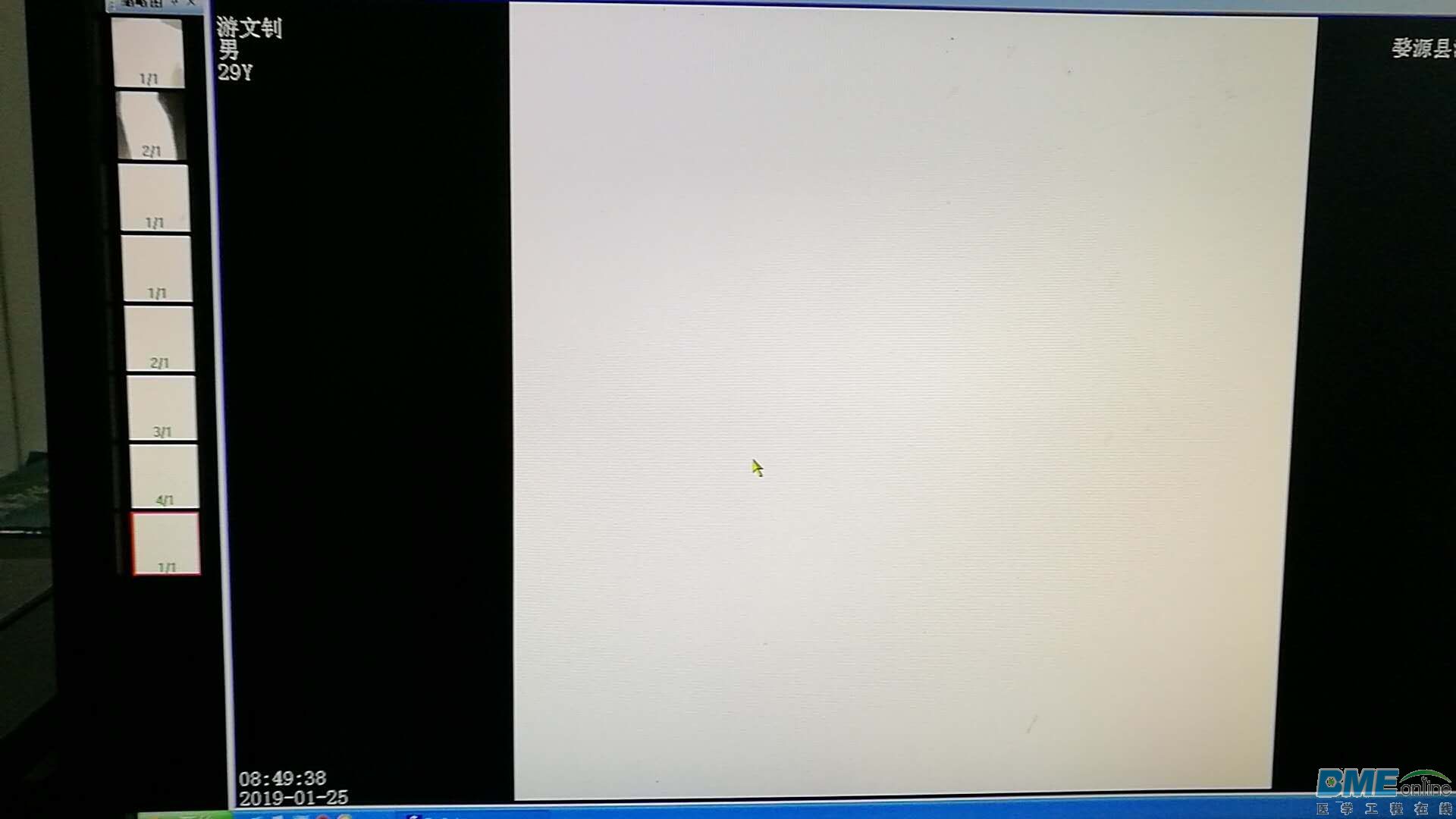 手机片子调整前