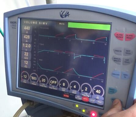 原装进口鸟牌呼吸机VELA